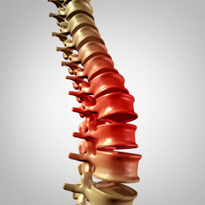 Spinal Cord Damage Symptoms
